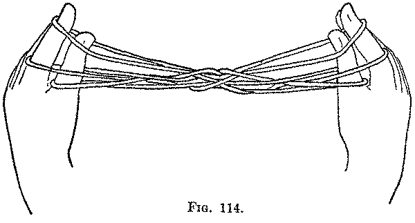 Fig. 114