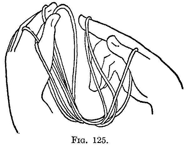 Fig. 125