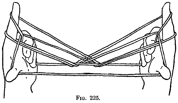 Fig. 225