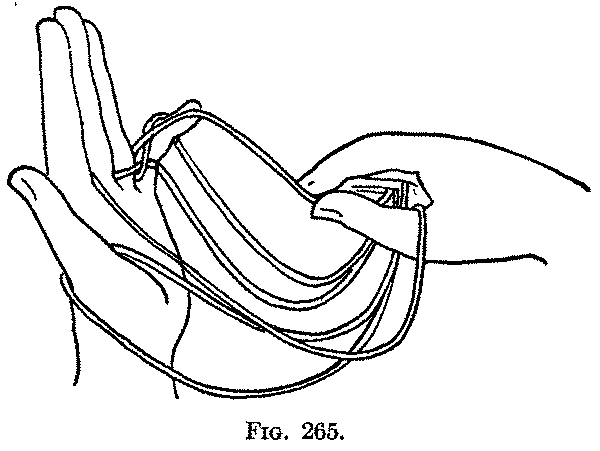 Fig. 265