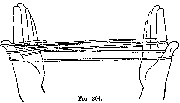 Fig. 304