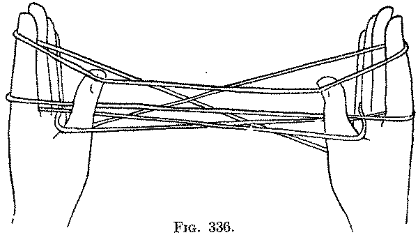 Fig. 336