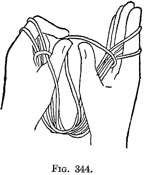 Fig. 344