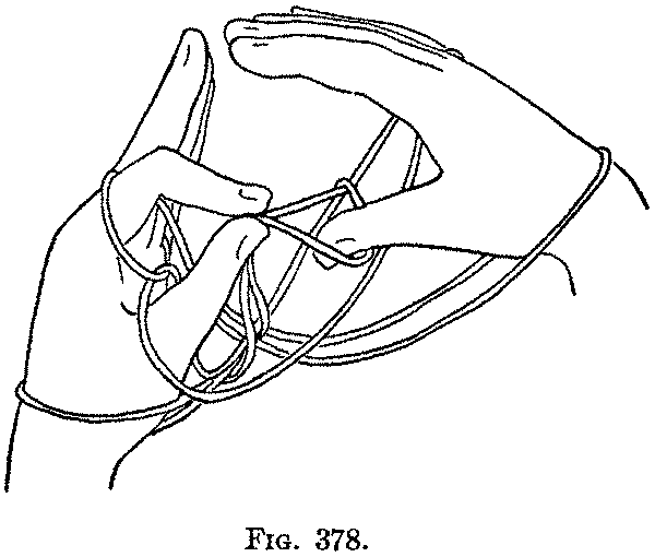 Fig. 378