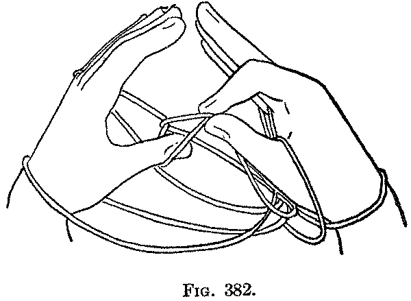 Fig. 382