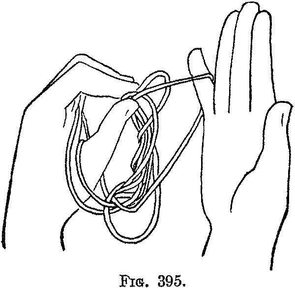Fig. 395