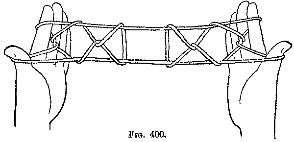 Fig. 400