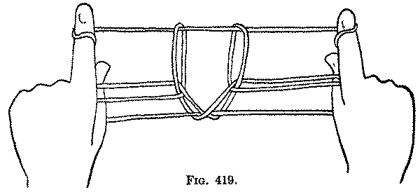 Fig. 419