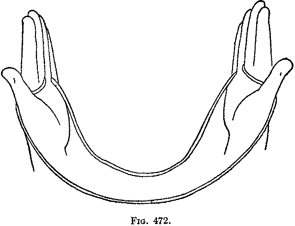 Fig. 472