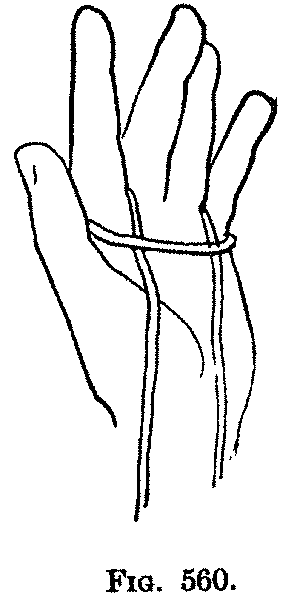 Fig. 560