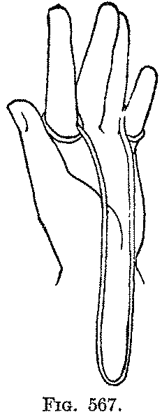 Fig. 567