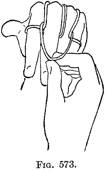 Fig. 573