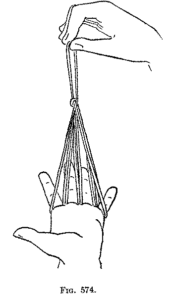 Fig. 574