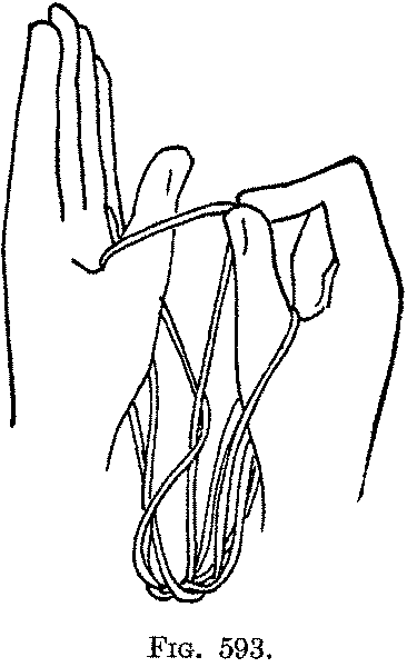 Fig. 593